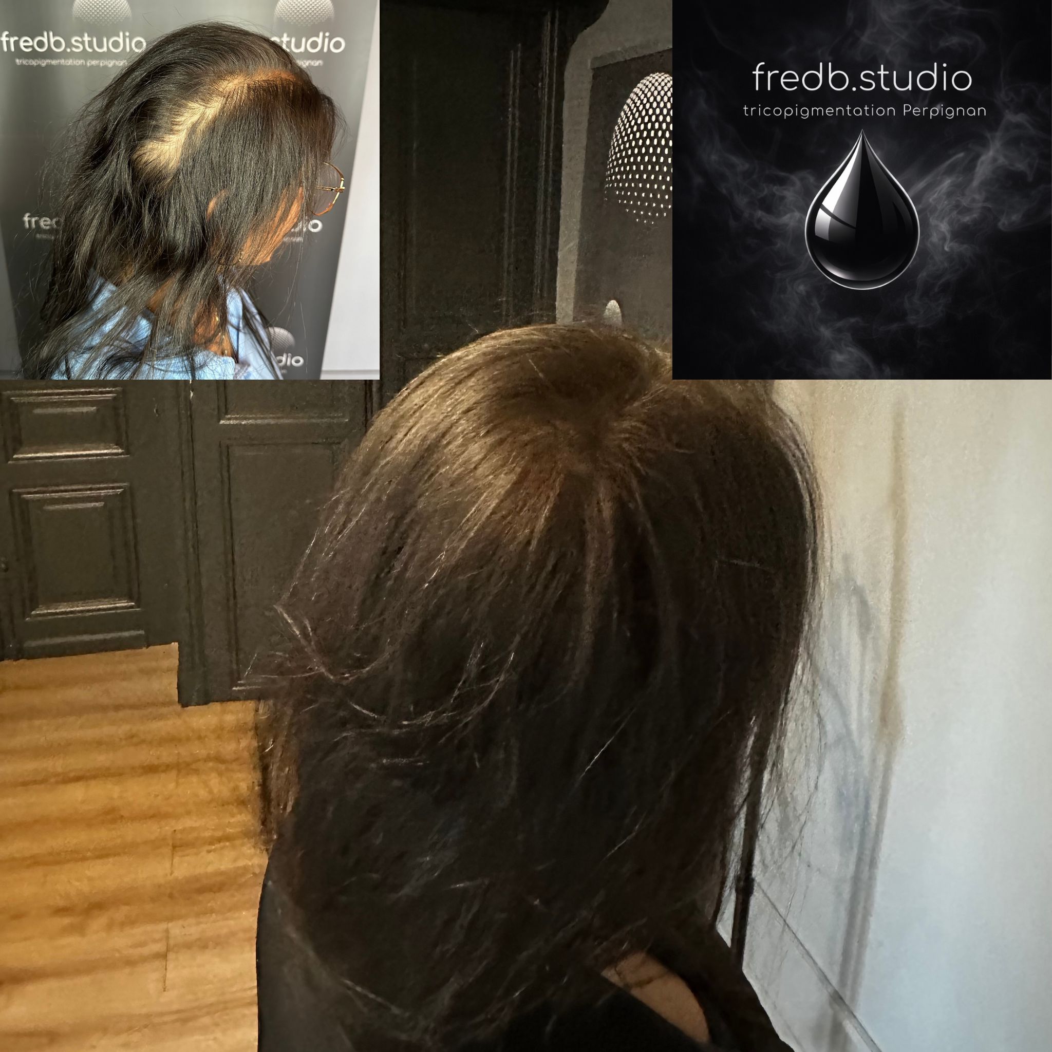 fredb.studio tricopigmentation Perpignan - Densification capillaire